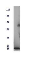 Human Galectin 7 protein, His tag