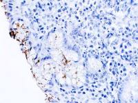 Helicobacter pylori 54kDa (flagellin) antibody [DBM15.75]