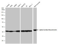 alpha Cardiac Muscle Actin antibody