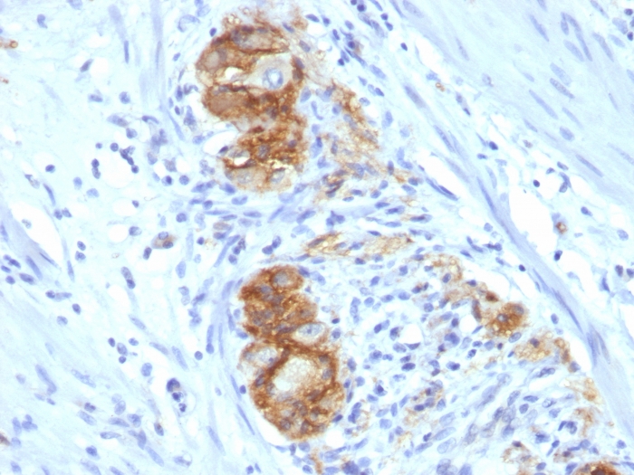 NCAM antibody [123C3.D5]