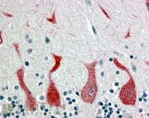 Retinoic Acid Receptor alpha antibody, C-term