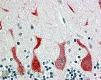 Retinoic Acid Receptor alpha antibody, C-term