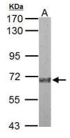 Plasma Kallikrein 1B antibody