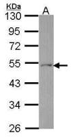 Ferredoxin Reductase antibody [N1C1]