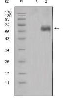 DKK1 antibody [2H2]