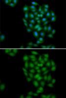 Phospholipid Scramblase 1 antibody