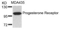 Progesterone Receptor antibody