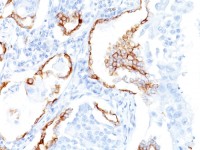 Cytokeratin 7 antibody [K72.7]