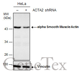 alpha Smooth Muscle Actin antibody