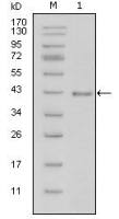 Laminin beta 1 antibody [2D9G5]