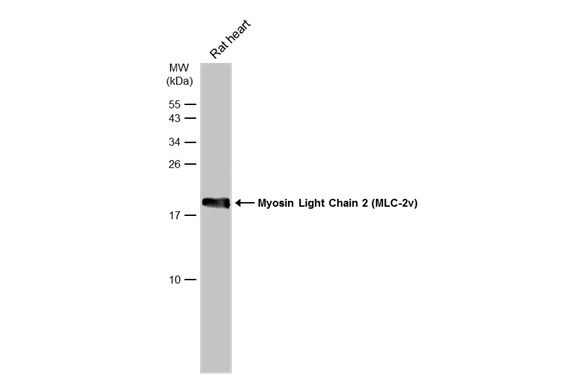 Myosin Light Chain 2 (MLC-2v) antibody