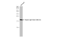 Myosin Light Chain 2 (MLC-2v) antibody