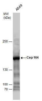 CEP164 antibody [17]