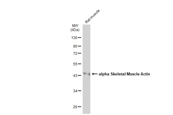 alpha Skeletal Muscle Actin antibody
