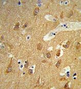 TSPAN12 antibody, C-term