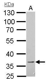 CD272 antibody
