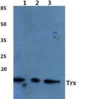 Thioredoxin antibody