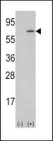 M-CSF antibody, Internal