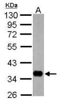 nrv1 antibody [N1N2], N-term