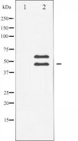 CaMK2 beta/ gamma/ delta antibody