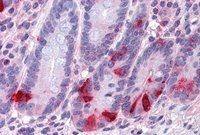 Chromogranin A precursor antibody, Internal