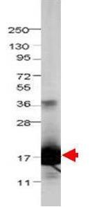 IL1F5 antibody