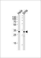 SNAI1 antibody, N-term