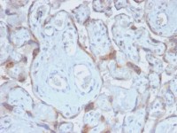 TIMP2 antibody [TIMP2/2488R]