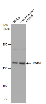 Rad50 antibody [N1N2], N-term