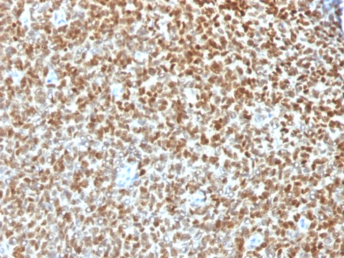 Nkx2.2 antibody [NX2/1422R]