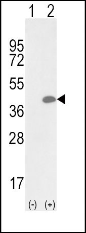 OLR1 / LOX-1 antibody, Internal