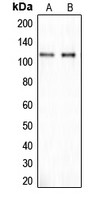 CYLN2 antibody