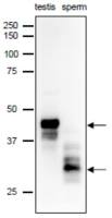 SPACA1 antibody