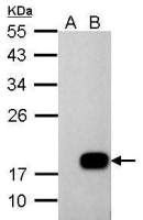 DCTD antibody
