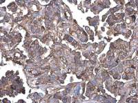 G protein beta antibody