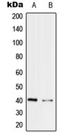 PRP18 antibody