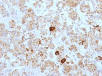 LH beta antibody [SPM103]