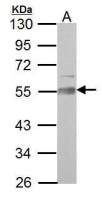 AAMP antibody