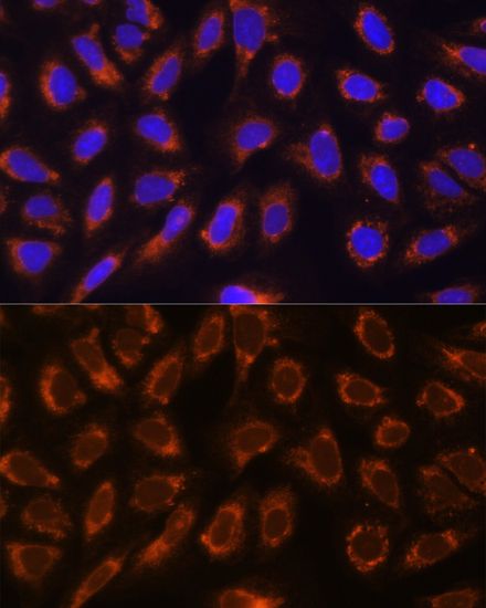 alpha Glucosidase II antibody