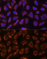 alpha Glucosidase II antibody