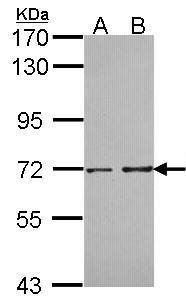 PPP2R5D antibody [C3], C-term