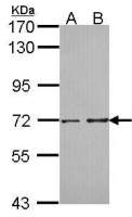 PPP2R5D antibody [C3], C-term