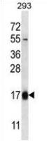 Hemoglobin theta 1 antibody