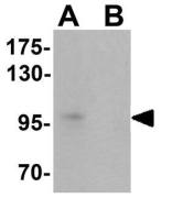 TSHZ2 antibody