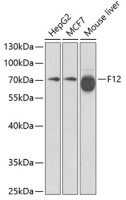 Factor XII antibody