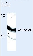 Caspase 6 antibody [3F52]