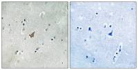 EphA3 (phospho Tyr779) / EphA4 (phospho Tyr779) / EphA5 (phospho Tyr833) antibody