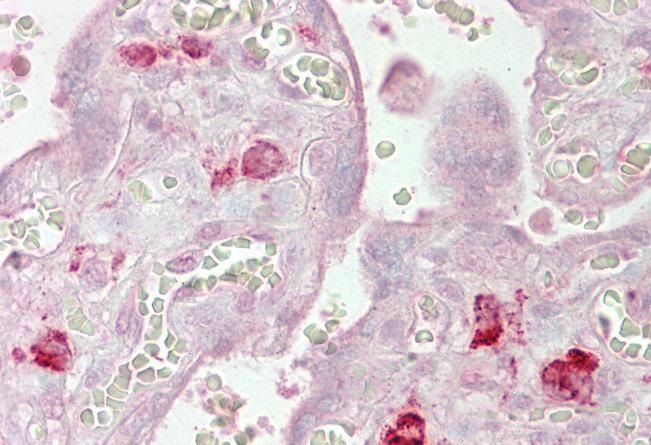 AGO1 antibody, Internal