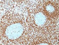 Bcl-2 antibody [124]