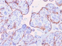 MMP3 antibody [rMMP3/1730]